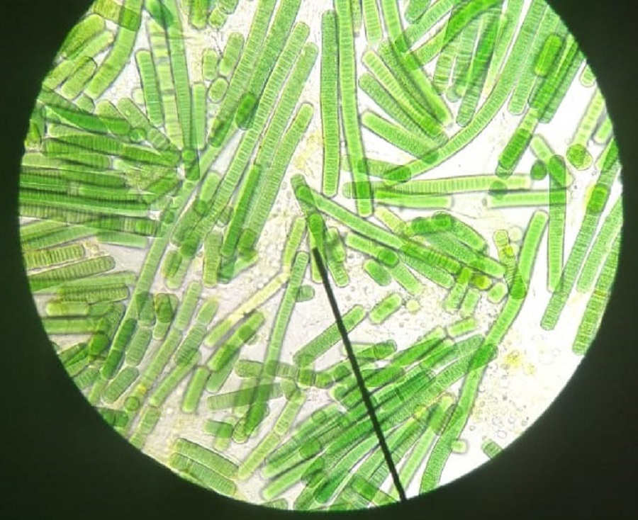 cianobactérias vistas de microscópio